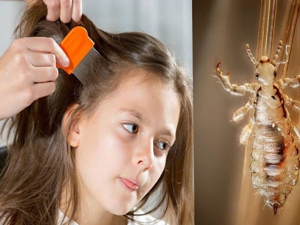 Nằm mơ thấy bắt chấy báo hiệu điều gì, số gì may mắn?